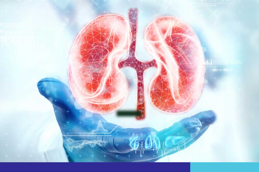 O que é cálculo renal  e como ele é formado?